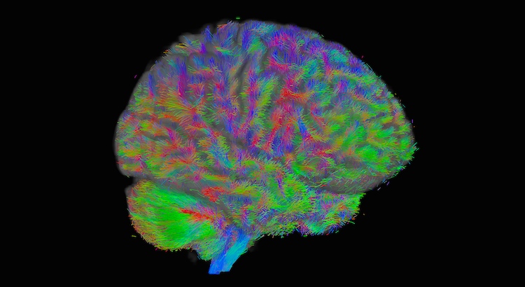 Global Tractography