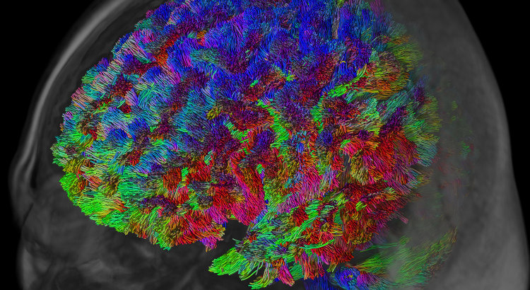 Robust FOD-based tractography